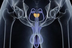 ProstateCancer share