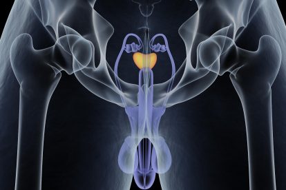 ProstateCancer share