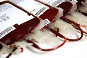 sangre transfusion 1