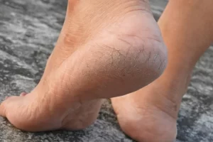 8666568334.png