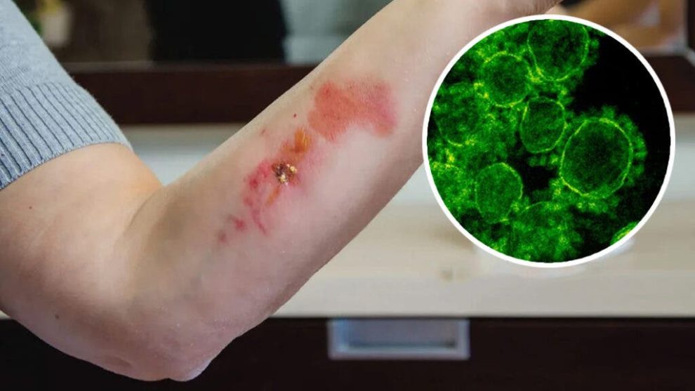 2025 08 804391858 1.png