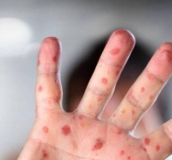 2026 01 959131886 1.png