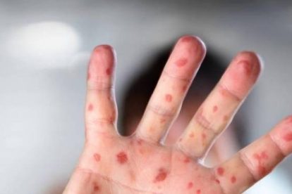 2026 01 959131886 2.png