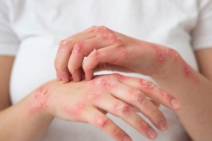 2026 01 960279324.png