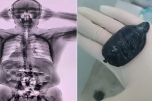 Detectan un pasajero con 48 capsulas de cocaina ingeridas en el aeropuerto de la 20260504 221149 S6Wu