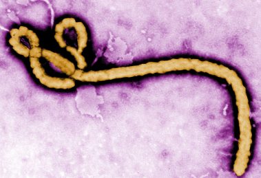 Ebola virus purple (1)