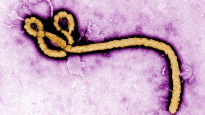 Ebola virus purple (1)